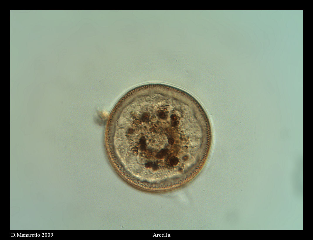 Arcella